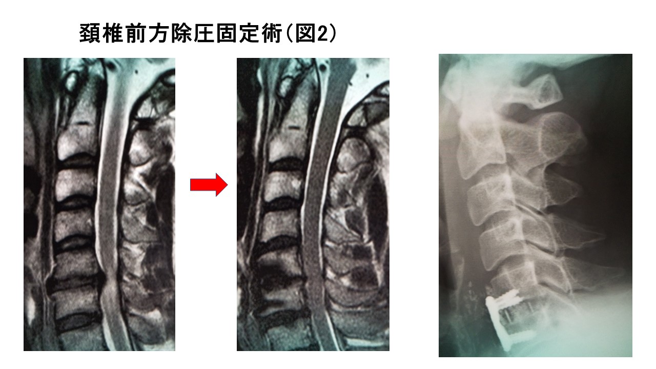 脊椎図2