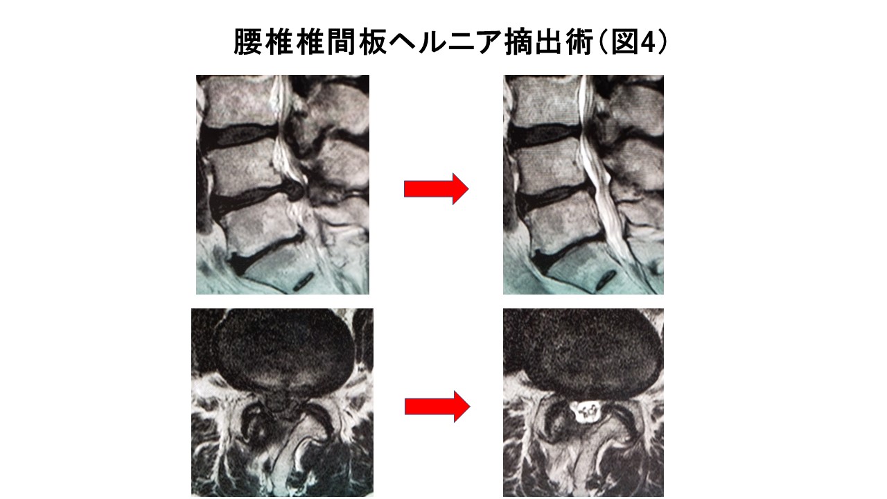 脊椎図4