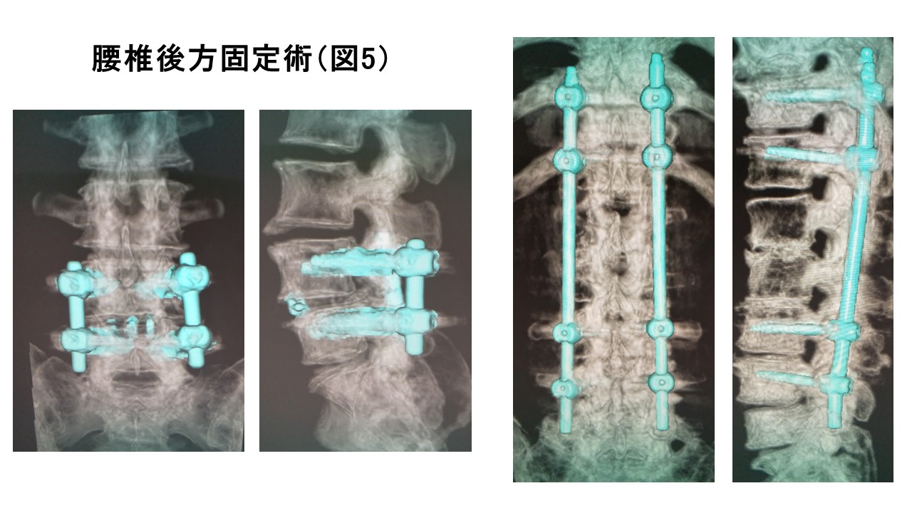 脊椎図5